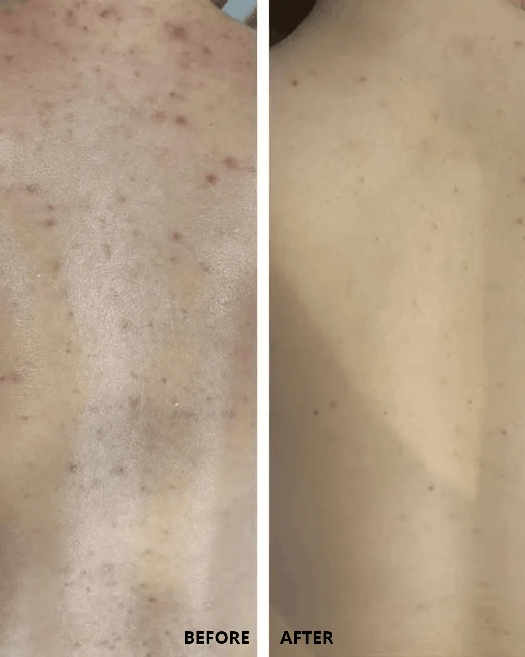 Angela Aesthetics local client feedback for the Algae Peel