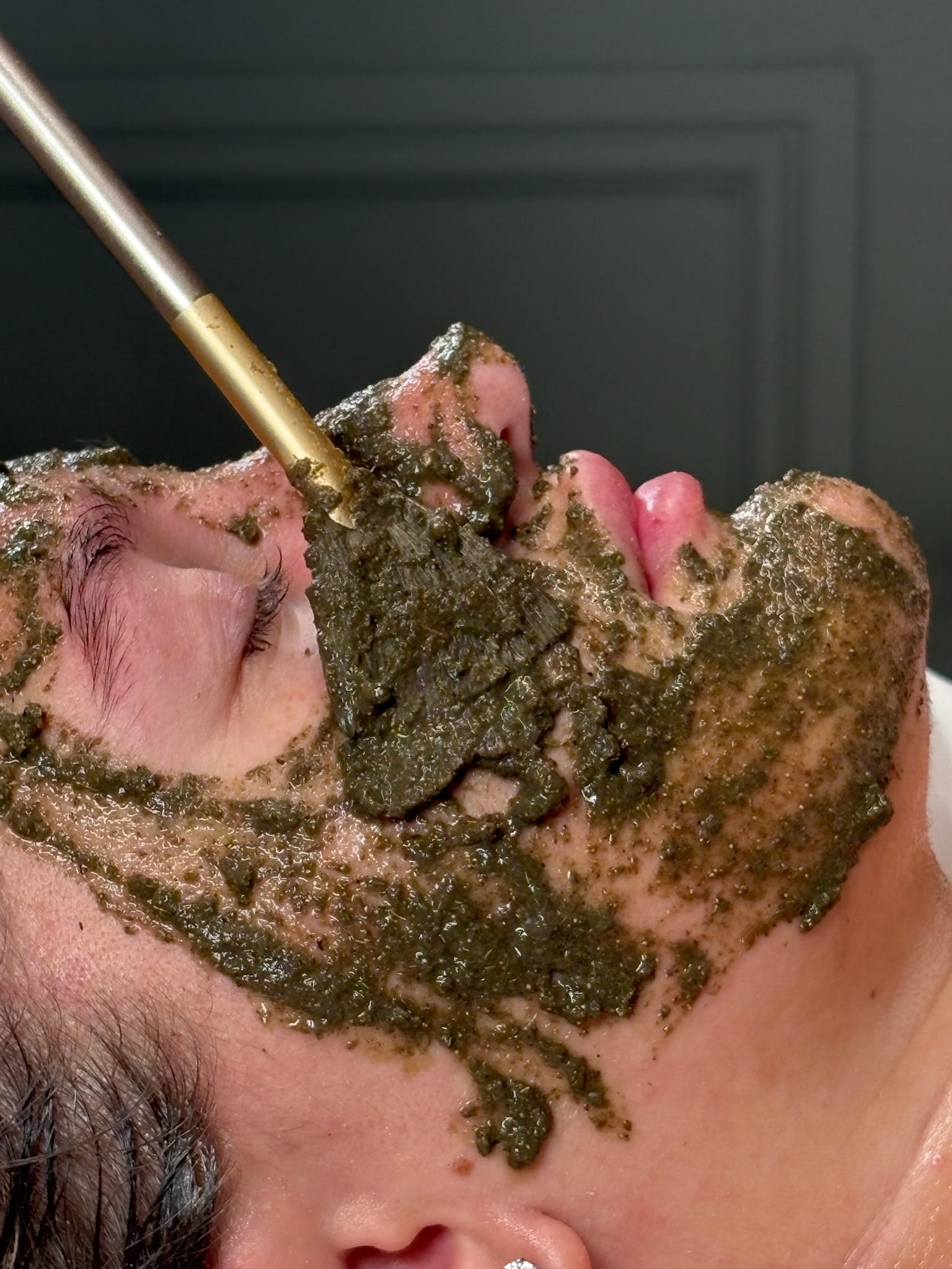 Algae Peel texture and treatment detail at Angela Aesthetics