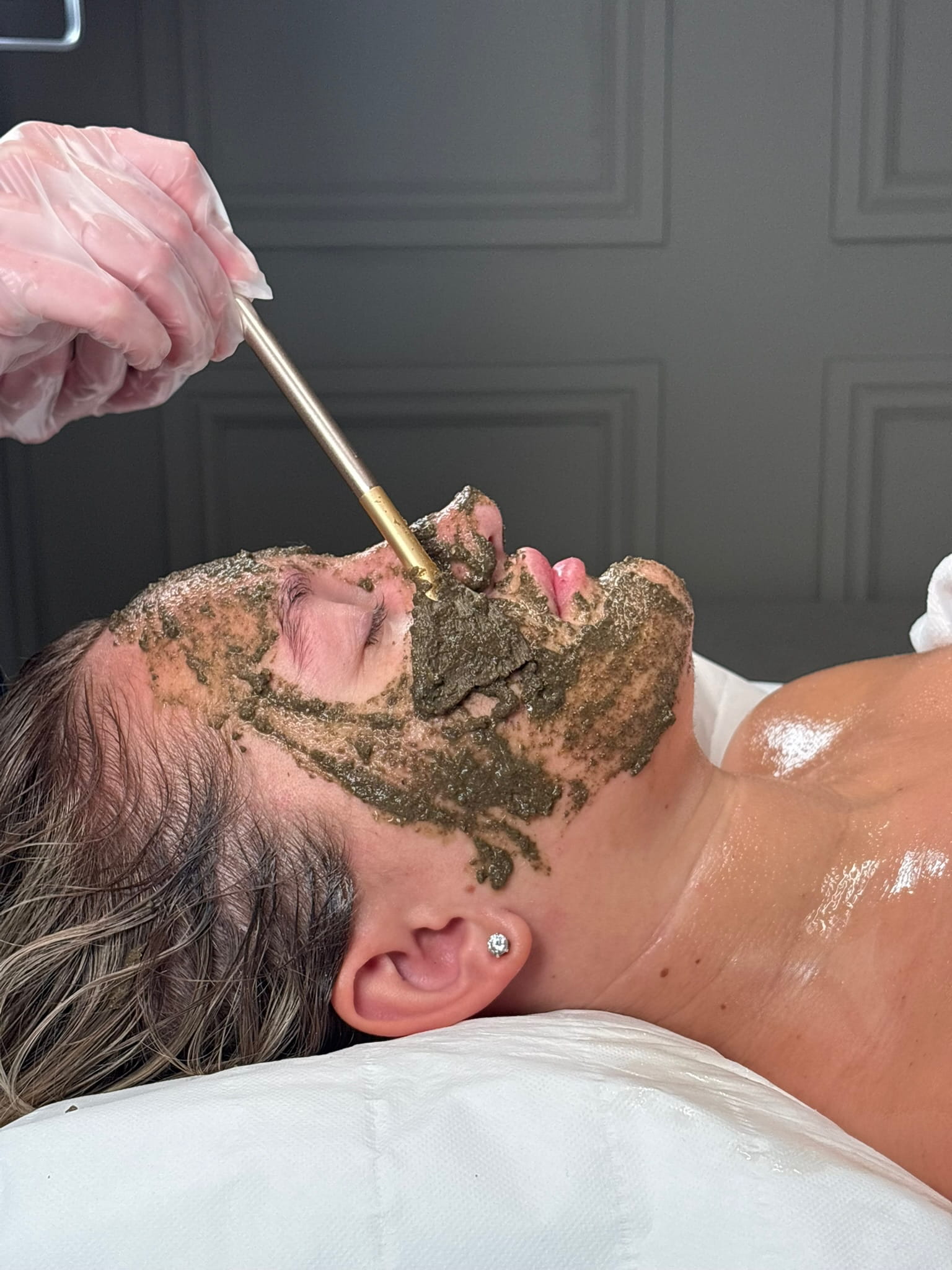 Algae Peel treatment being applied at Angela Aesthetics